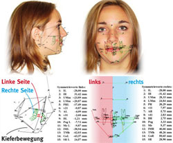 Analyse noXrayCeph®